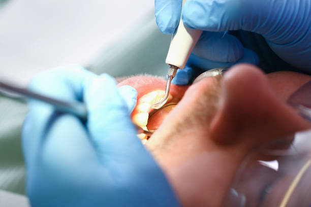Best Emergency Gum Treatment in Grosse Pointe, MI