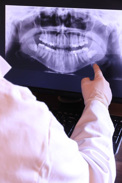 Best Emergency Gum Treatment in Grosse Pointe, MI