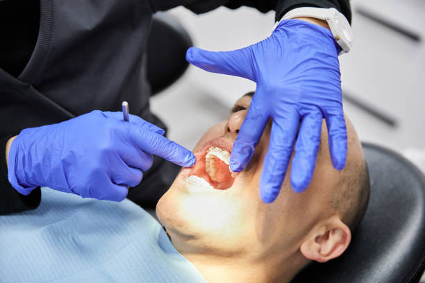 Best Emergency Dental Care for Broken or Chipped Teeth in Grosse Pointe, MI